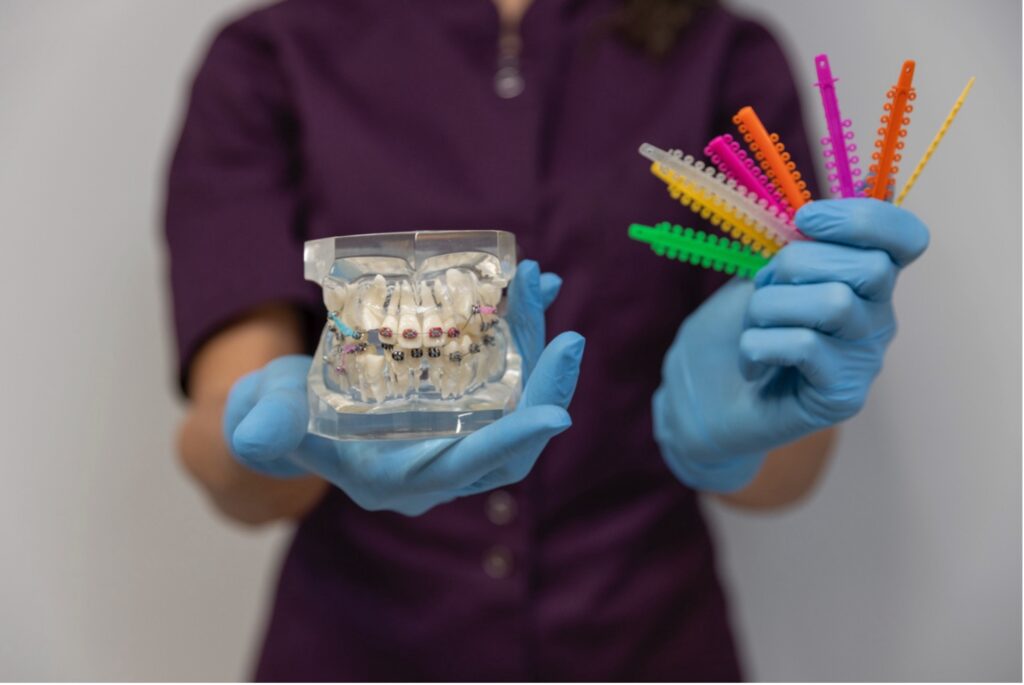 Operatore con guanti che mostra un modello dentale con apparecchio fisso e legature ortodontiche colorate